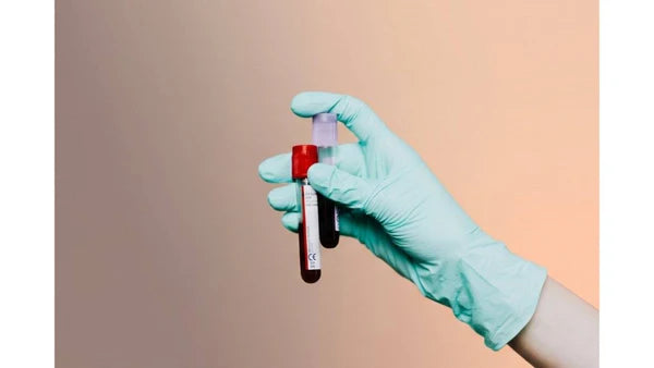 miCheckup Cancer Test — Reserve & Save $500